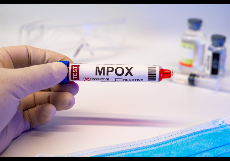 Health Advocates Demand Lower Prices for Mpox Tests from Cepheid